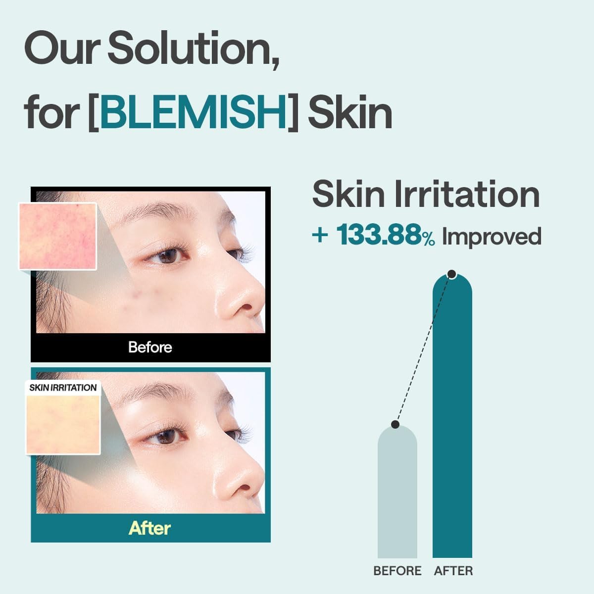 Mediheal Essential Face Mask [Madecassoside] Blemish Repair 10 pcs. with 98% Purity Madecassoside & Hyaluronic Acid - Soothing Care, Hydrating- Travel Essentials, Vegan Formula Korean Sheet Mask