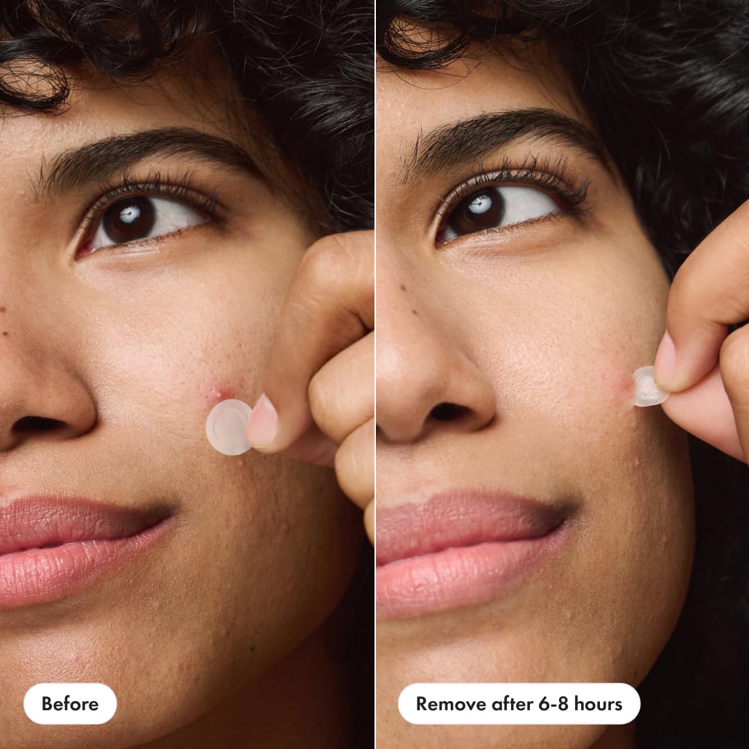 Mighty Patch™ Invisible+ Patch – The Barely-There Daytime Hydrocolloid Acne Pimple Patch for Covering Zits and Blemishes, Tapered Edges Designed to Blend Into Skin (72ct)