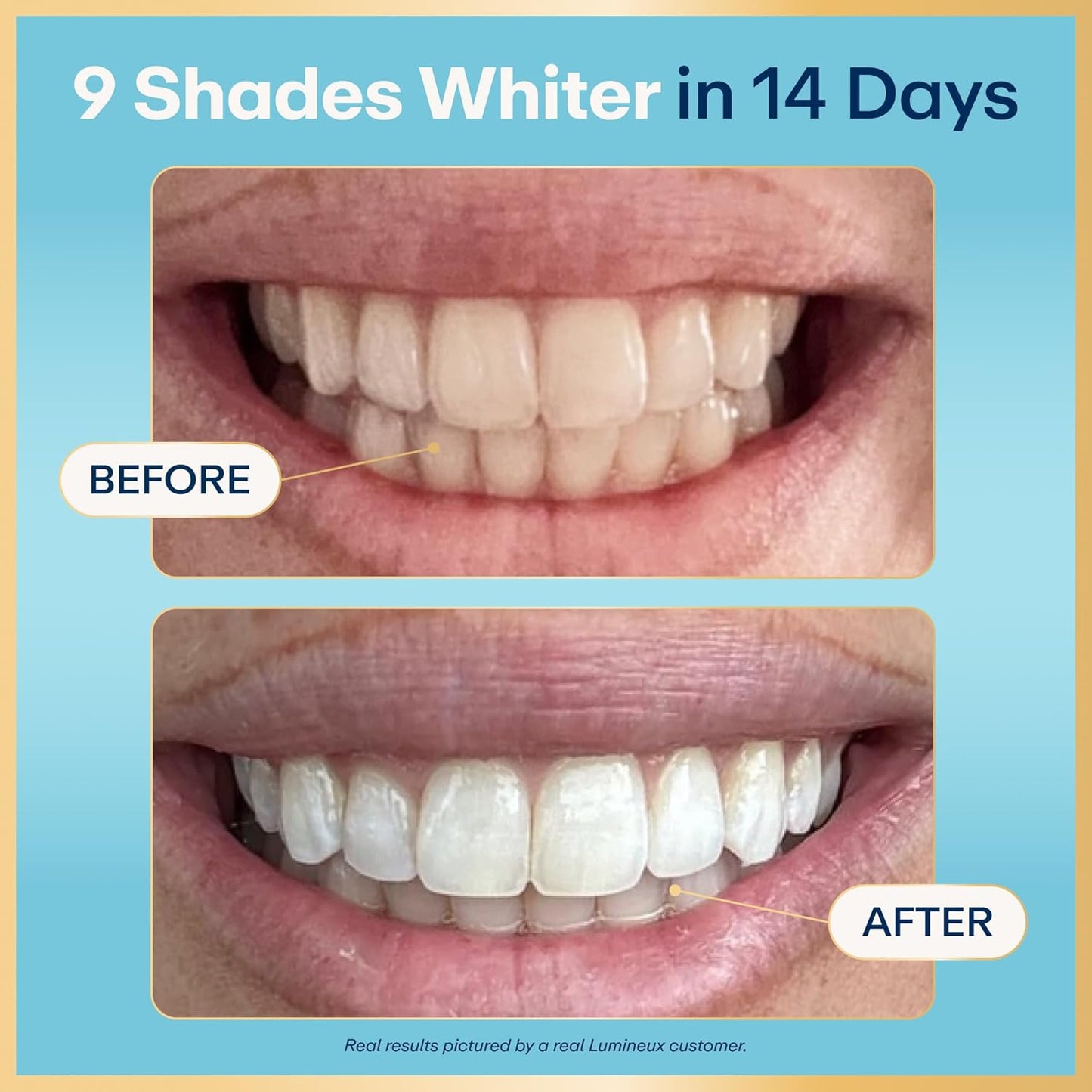 Lumineux Teeth Whitening Strips Kit - 9 Treatments (1 Month) - Peroxide Free - Enamel Safe for Whiter Teeth - Whitening Without The Sensitivity - Dentist Formulated - Sensitivity Free