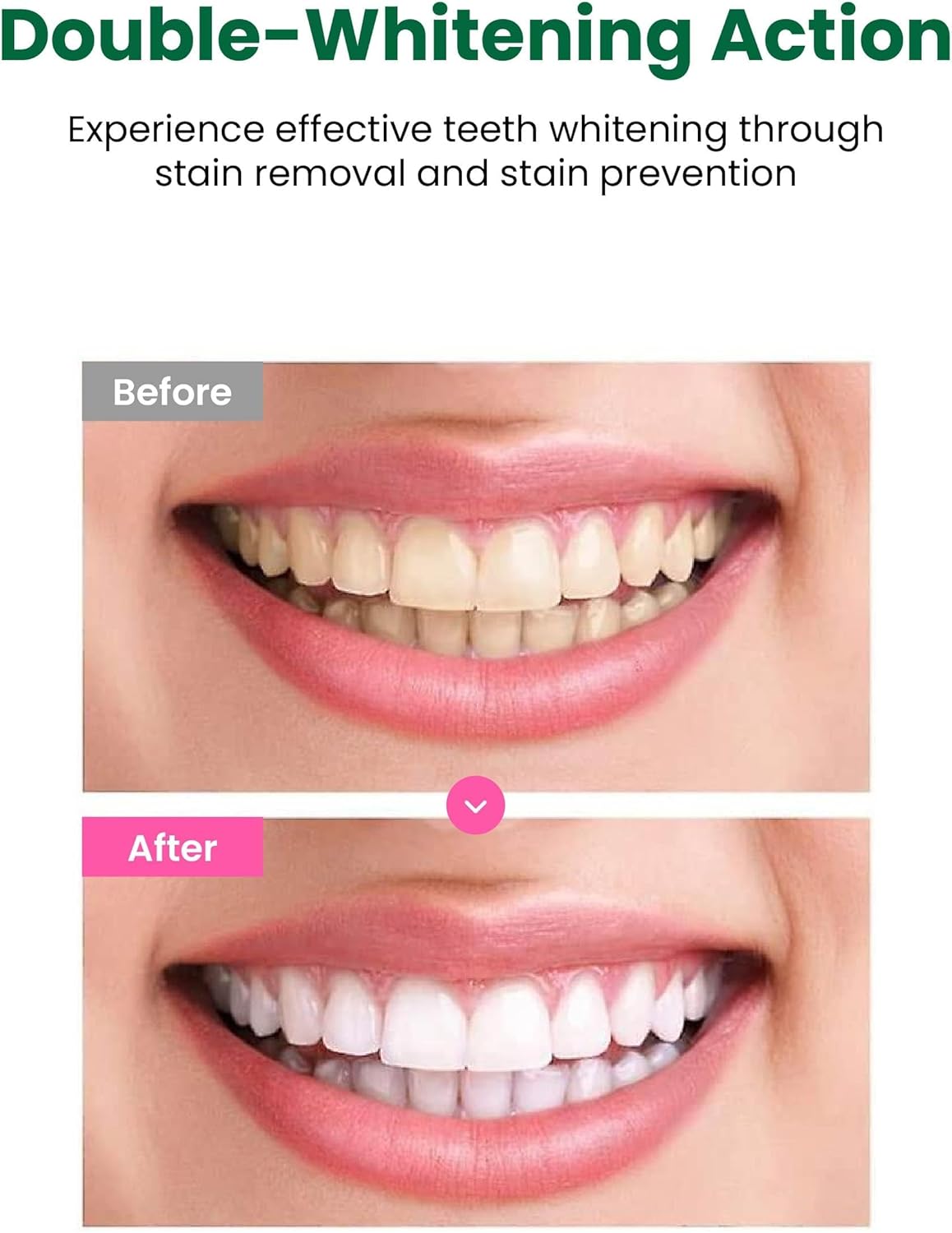 EUTHYMOL Whitening Toothpaste (3.7fl oz) - Stain Removal in 2 Weeks, Long-Lasting Freshness for Sensitive Gum & Teeth. Bad Breath, Cavity Prevention. Recyclable Aluminum Tube