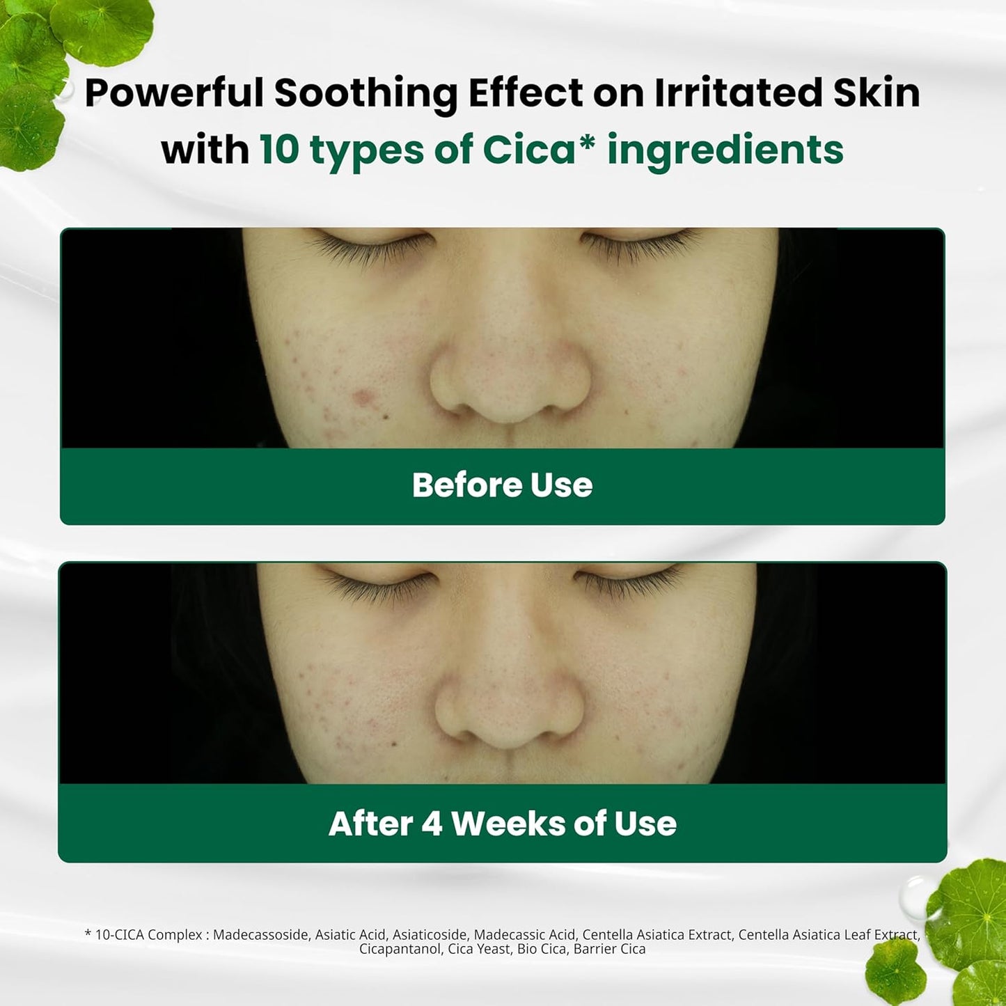 Dr. G R.E.D. Blemish Clear Soothing Cream - Calming Korean Moisturizer for Redness - Soothes Acne & Irritation - With Centella Asiatica - Long-Lasting Hydration - 2.36 fl oz