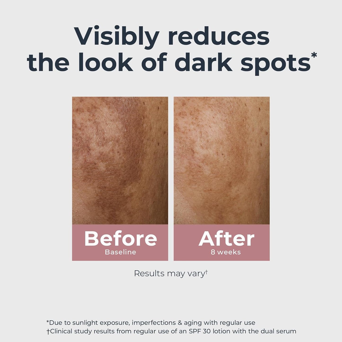 Eucerin Radiant Tone Dual Serum Dark Spot Corrector, Dark Spot Serum with Thiamidol and Hyaluronic Acid, Helps Visibly Reduce the Look of Persistent Dark Spots, 1 Fl Oz Bottle