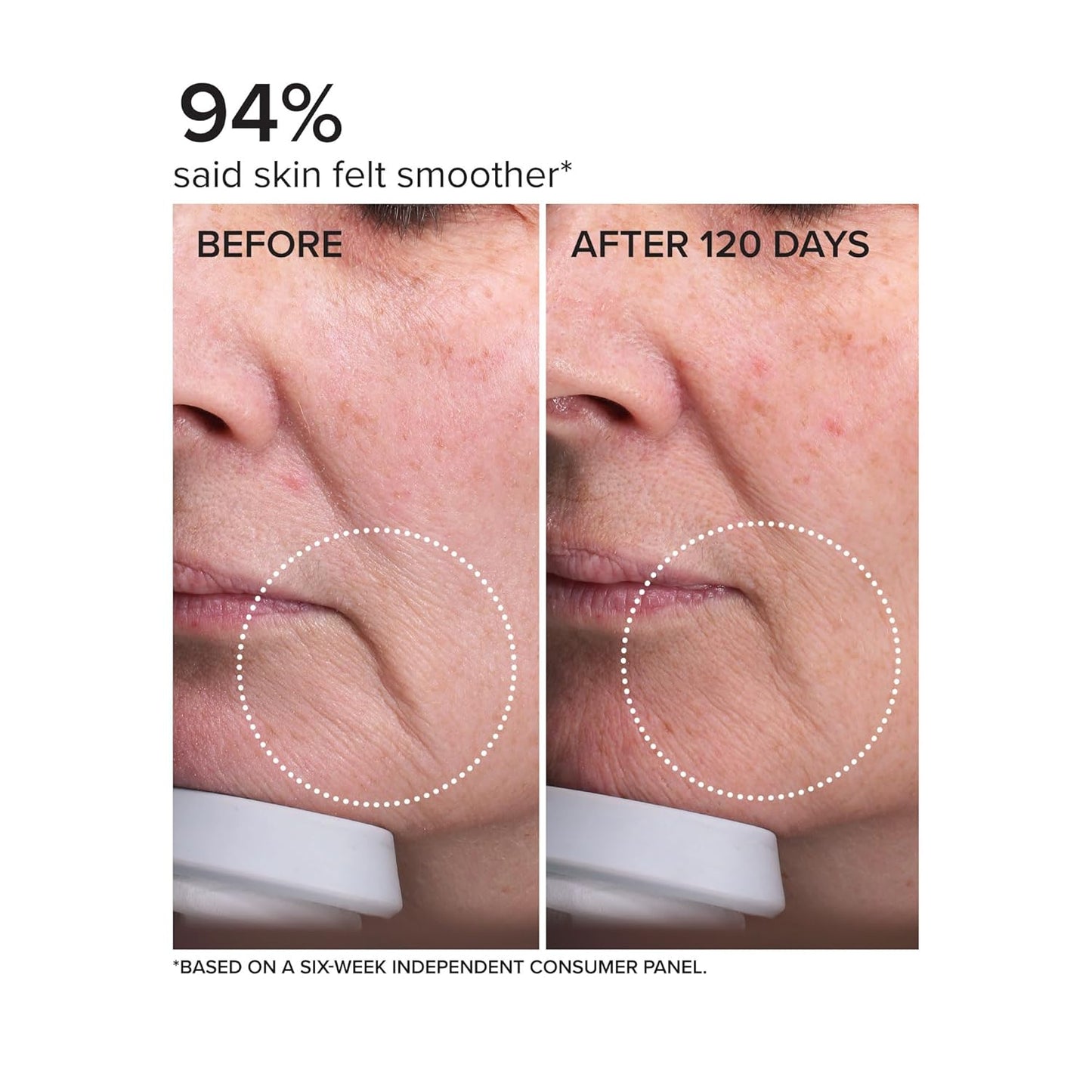 DRMTLGY Needle-less Serum – Peptide & Ceramide Face Serum for Fine Lines & Wrinkles, Hydrating & Firming Anti Aging Serum with Niacinamide & Hyaluronic Acid, Smooths & Plumps Skin, 1 oz