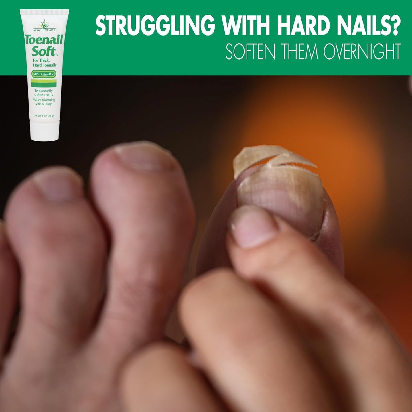 Toenail Softener for Thick Hard Toenails - Safe for Seniors & All Ages - Fast-Acting Toenail Softening Cream - Non Greasy Nail Cream Formulated with Natural Aloe Vera (1 Ounce Tube (Pack of 1))