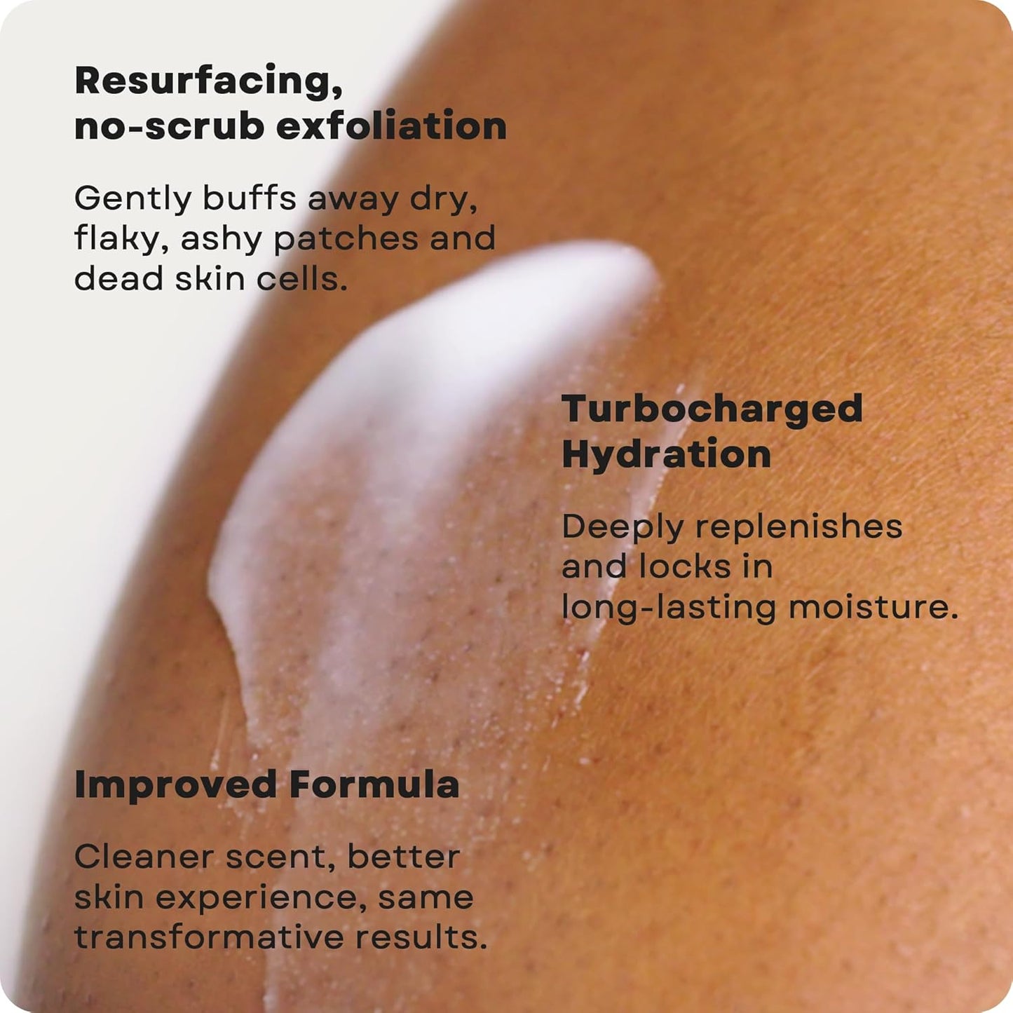 AmLactin Intensive Healing Body Lotion - Therapeutic Lotion for Extremely Dry Skin - No-Scrub Exfoliator and Moisturizer with 15% Lactic Acid AHA and Ceramides, 14.1 oz (Packaging May Vary)