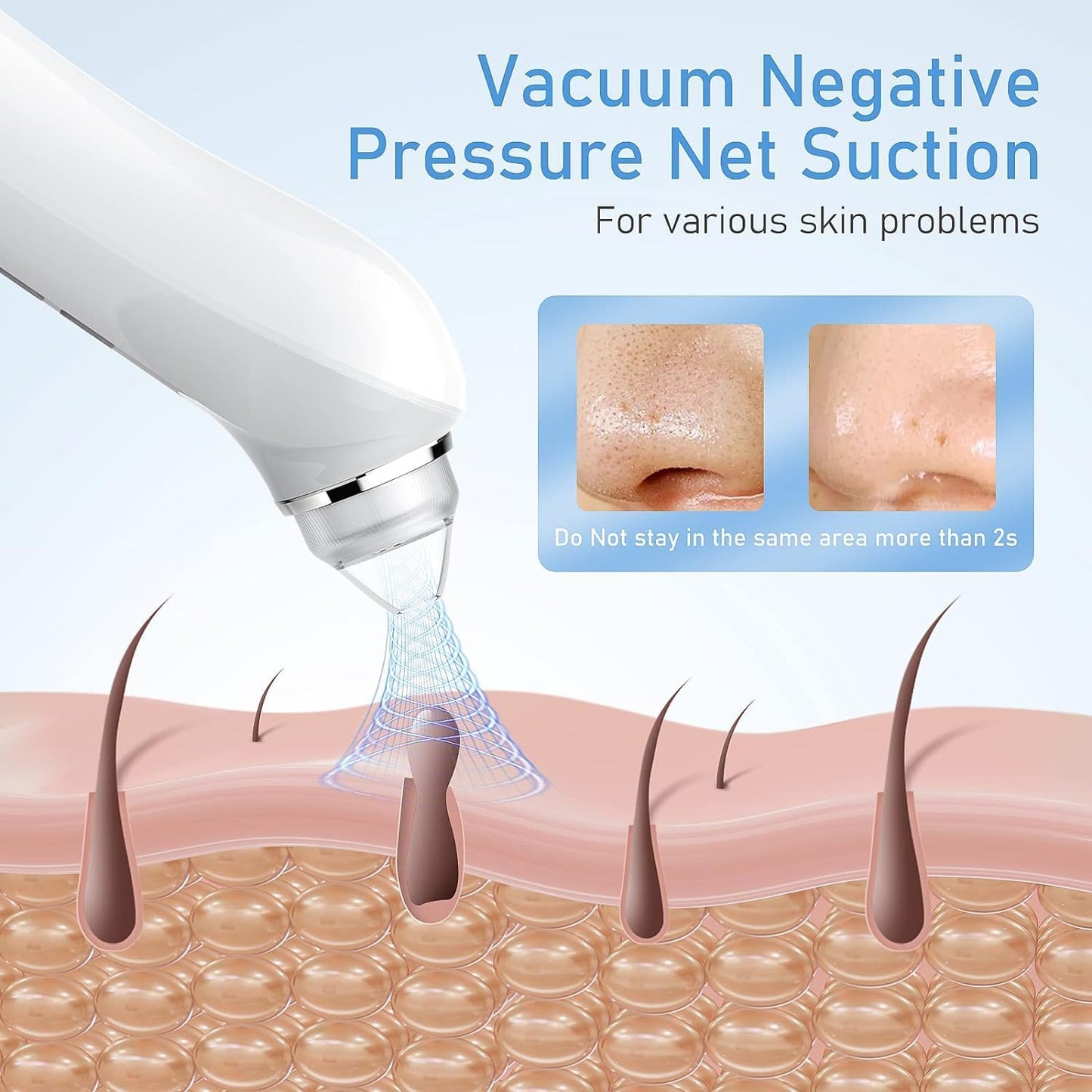 Blackhead Remover Vacuum, USB Interface Type Pore Vacuum, Black Head Extractions Tool with Camerafor, Men and Women Pore Cleaner, 3 Adjustment Modes & 6 Suction Heads(Light Pink)