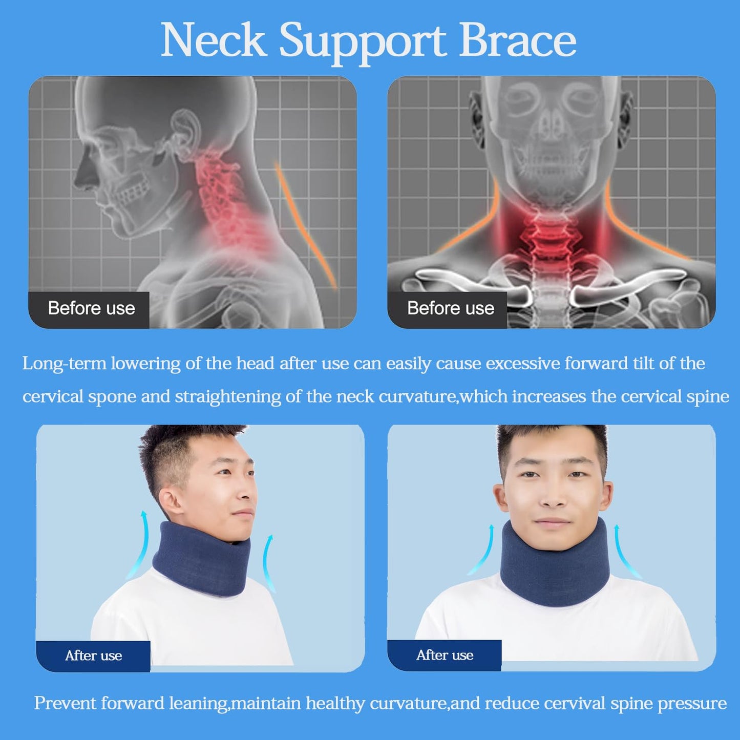 Neck Braces for Neck Pain and Support High-Density Comfort Cervical Collar for Vertebrae Stable and Aligned, Relieve Injury Spine Pressure – Neck Brace for Women & Men Sleeping, Working (1, Blue, Medium)