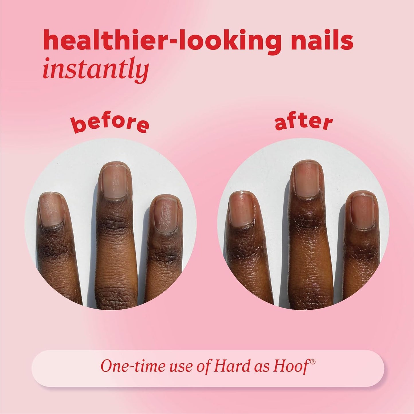 Onyx Professional Hard As Hoof Nail Strengthening Cream, Unscented - Nail Growth & Conditioning Cuticle Cream Stops Splits, Chips, Cracks & Strengthens Nails, 1 oz