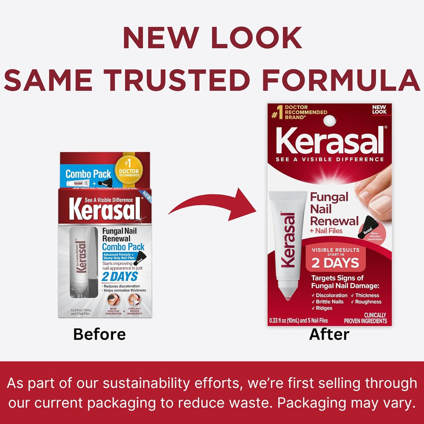 Kerasal Nail Renewal and Nail File Combo Pack, Restores Appearance of Discolored or Damaged Nails, 5 Heavy Duty Nail Files, 0.33 fl oz, Clear (Packaging May Vary)
