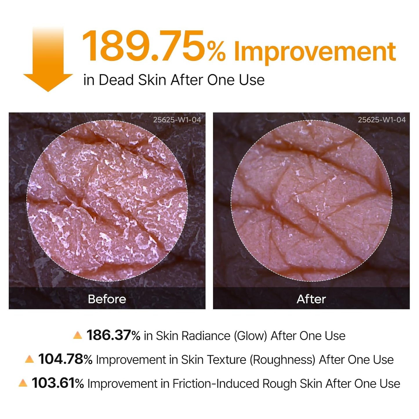 Dr.Melaxin Body Keratin Care Kojic Acid Turmeric Spray Gently Exfoliating Peeling Solution Korean Skincare All Skin Types 200ml