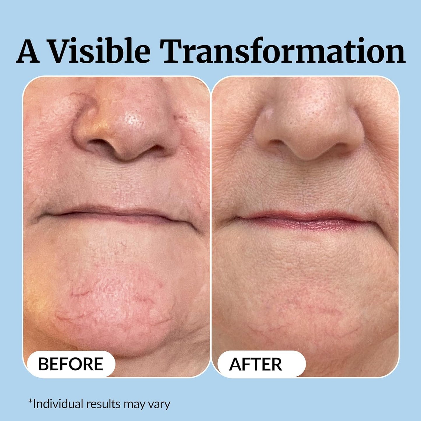 Vibriance Super C Serum for Mature Skin - All-in-One Vitamin Formula Hydrates, Firms, Lifts, Smooths, Targets Age Spots, Wrinkles, 1 fl oz